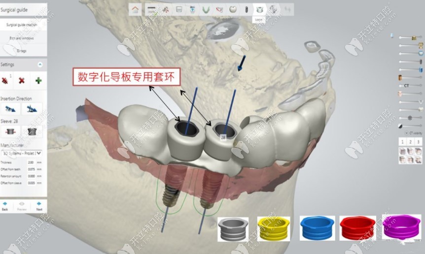 菲森科技2024華南國際口腔展圓滿收官！一站式口腔數(shù)字化解決方案閃耀全場