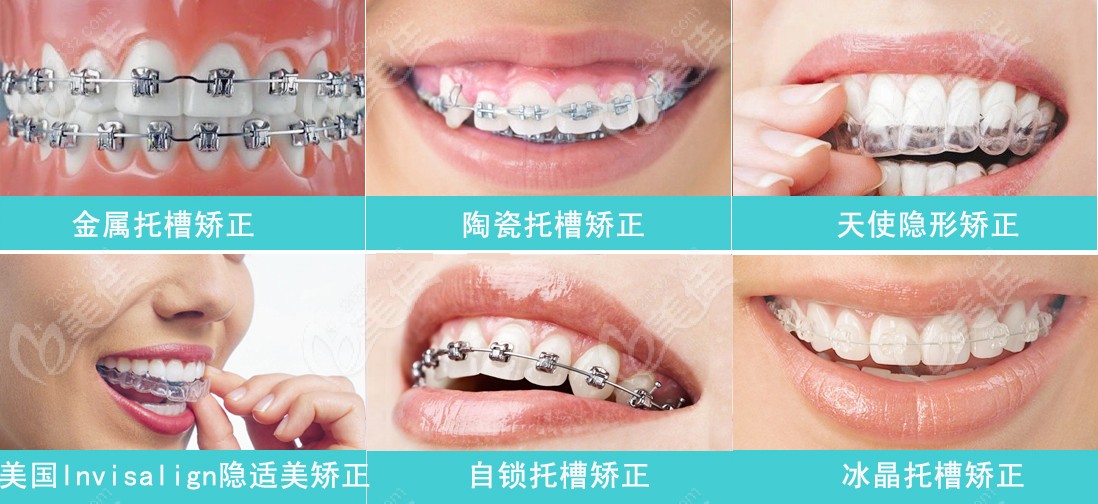 兒童牙齒矯正不是越早越好