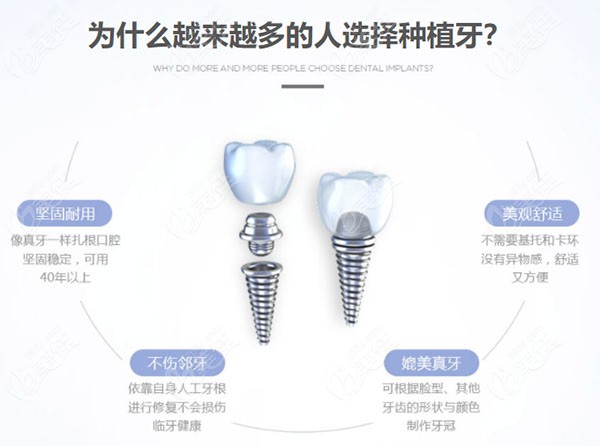 前瞻性布局口腔數(shù)字化平臺(tái)解析隱形獨(dú)角獸「登特菲」高速成長密碼