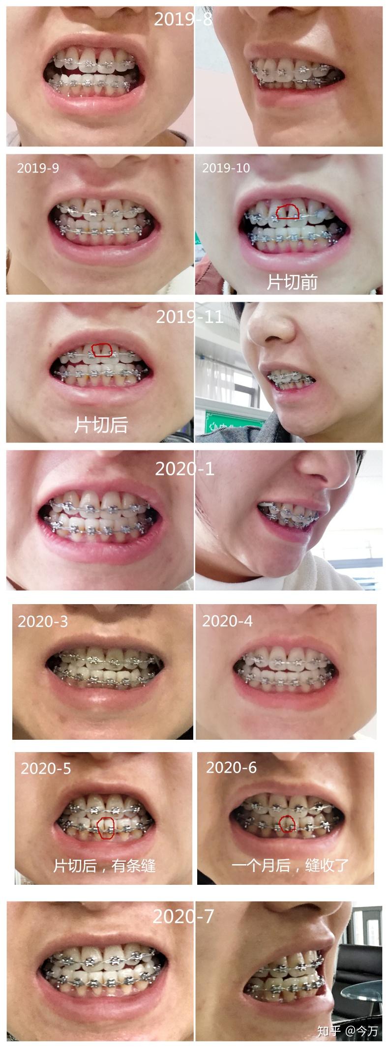 Kaiyun：孕婦夢(mèng)見刷牙是什么意思