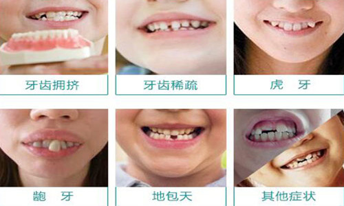 牙齒矯正有年齡限制嗎？