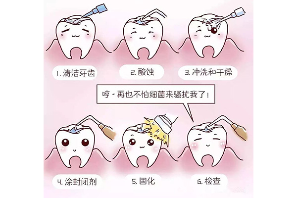 便民提示：孩子牙齒矯正要趁早