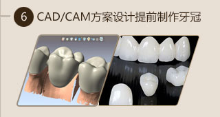 數(shù)字化種植技術(shù)助力口腔健康患者重拾自信笑容